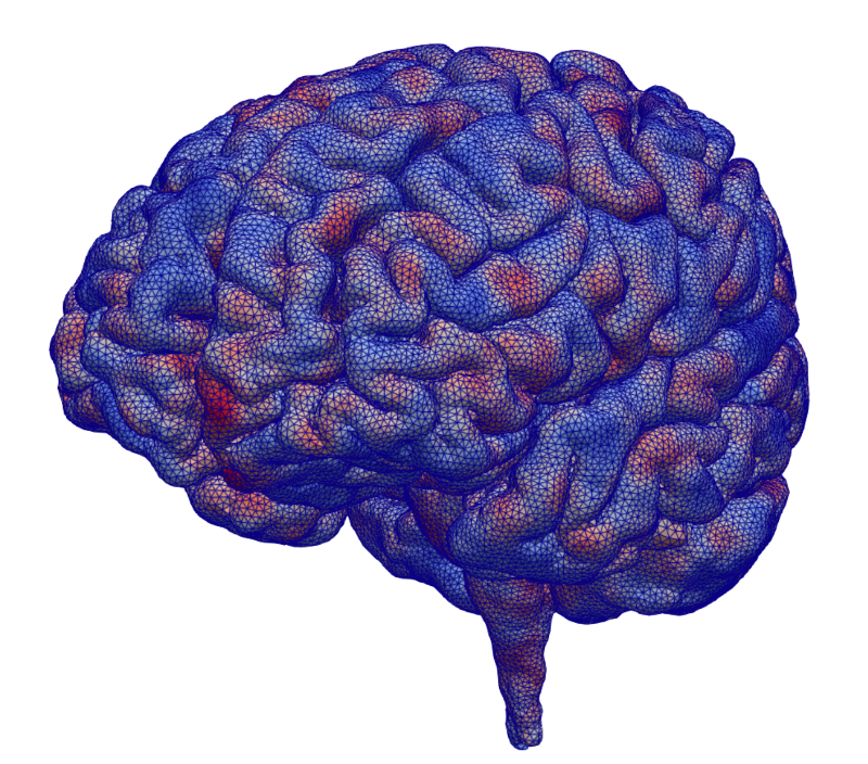 A blue and red grid over top a detailed image of a brain