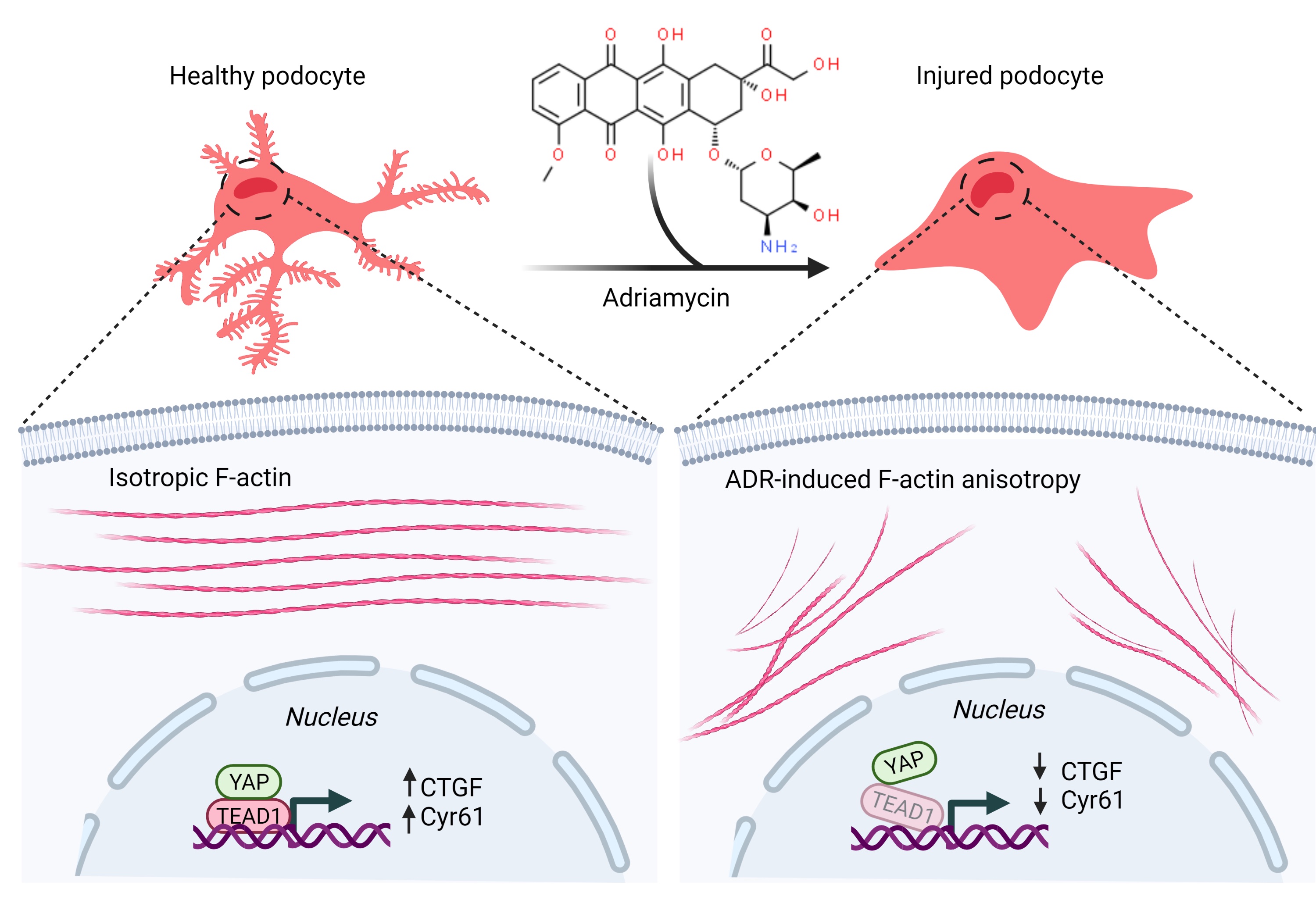 The graphic shows how the use of adriamycin caused the podocytes to become injured and collapse