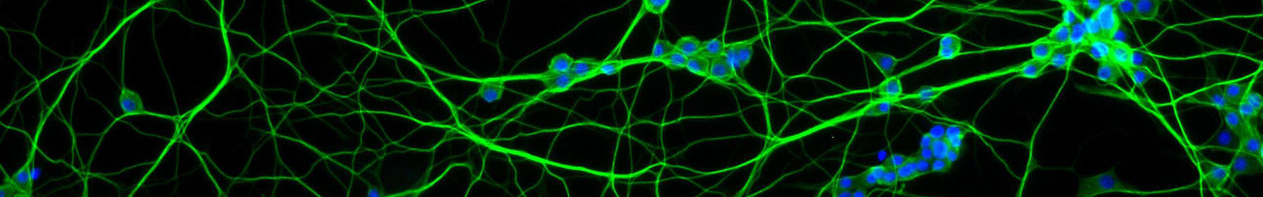 neural engineering research image from Jennifer West lab