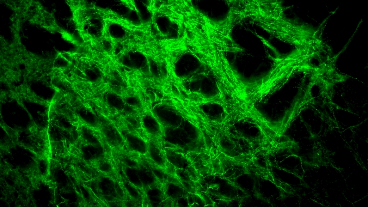 A fluorescent green tangled web against a black background