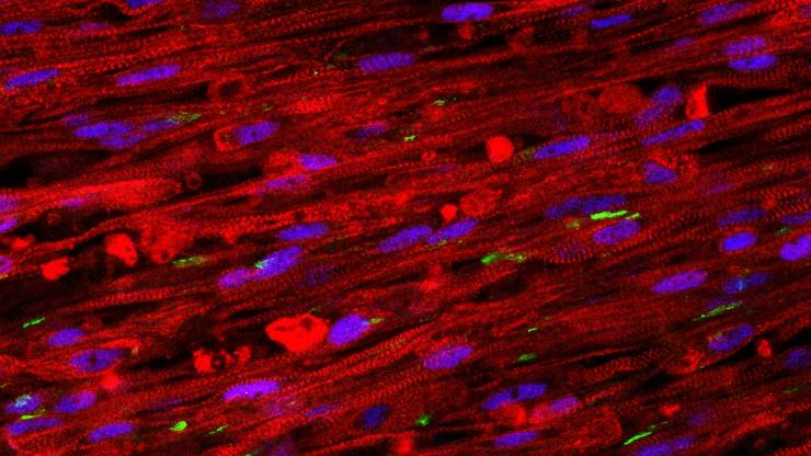 A stained cross section of the new muscle fibers. The red cells are striated muscle fibers, the green areas are receptors for neuronal input, and the blue patches are cell nuclei. (Credit: Bursac Lab)