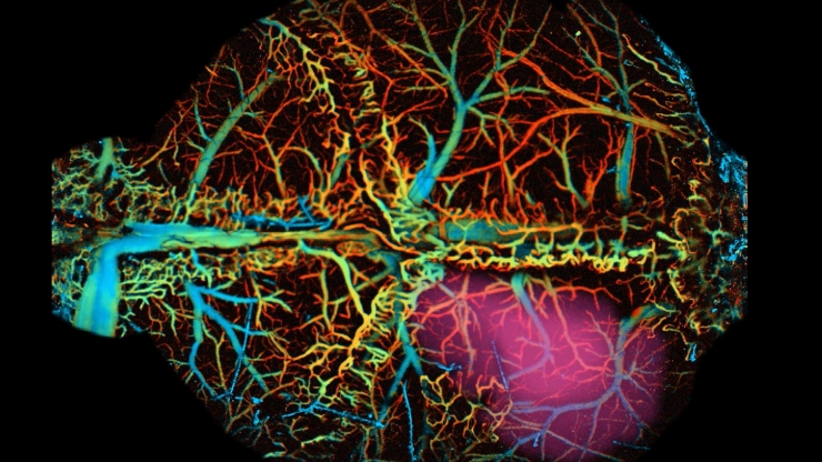 This high-resolution photoacoustic and fluorescent image of a mouse brain shows the brain’s oxygenation from green (veins) to red (arteries) and the neural activation region is purple.
