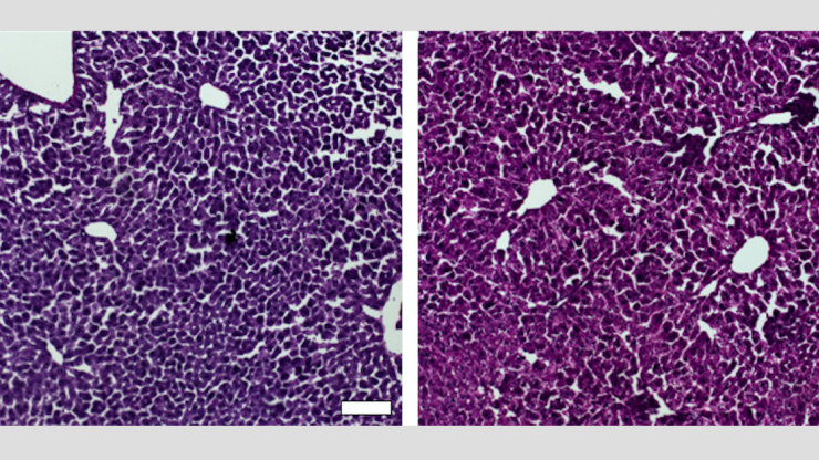 Histological sections of liver from control mice treated with saline (left) and the CRISPR/Cas9 epigenetic repression system in which cholesterol levels were lowered (right) show generally normal and healthy tissue