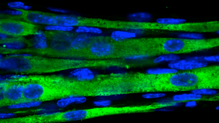 stained green and blue muscle fibers