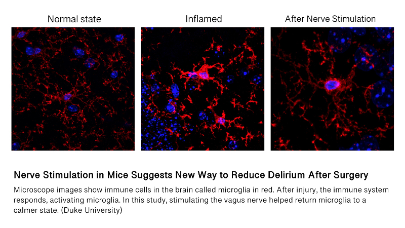 stained slides of cells before and after vagus stimulation