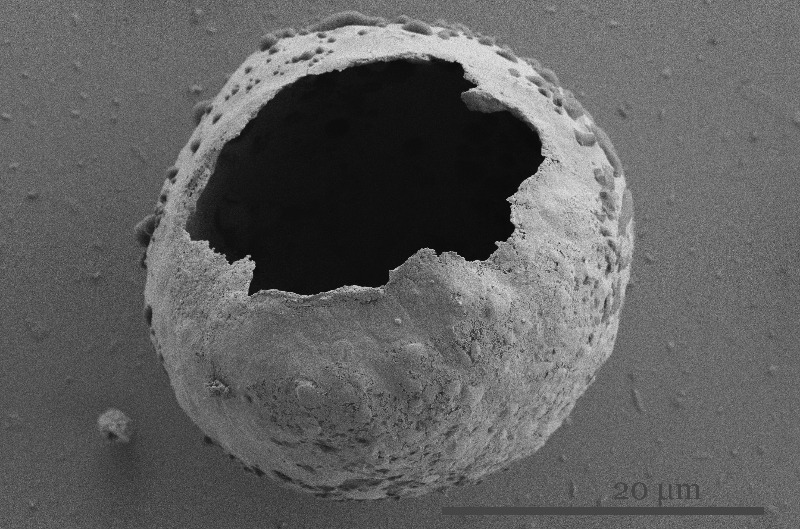 image of possible spore taken with SEM