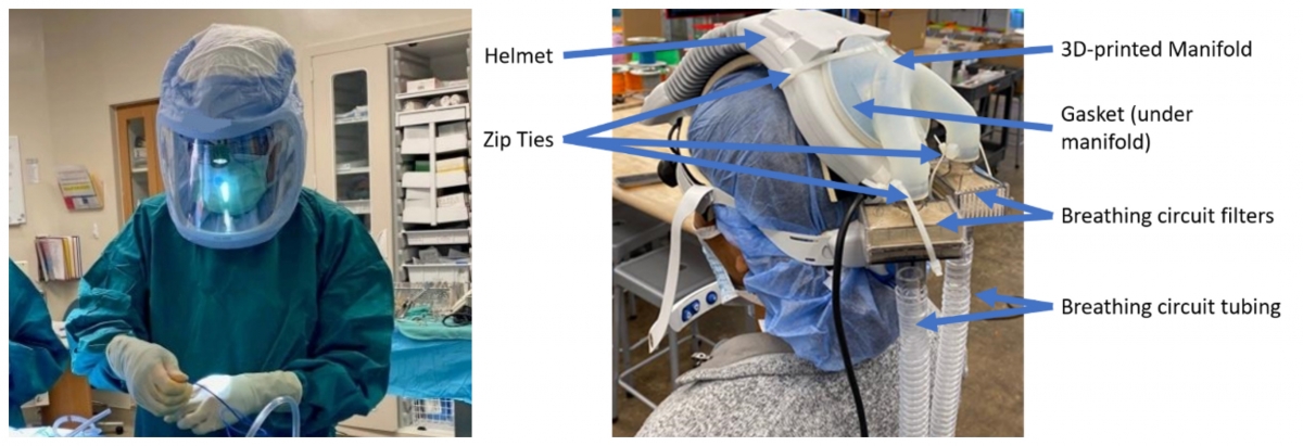 3D SHIELD surgical hood in clinical use; annotated image