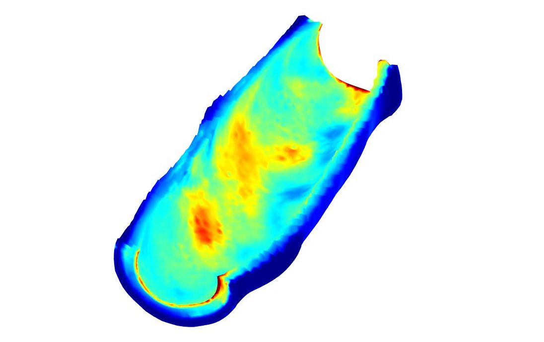 Red and blue gradient colored over top a detailed image of a human artery