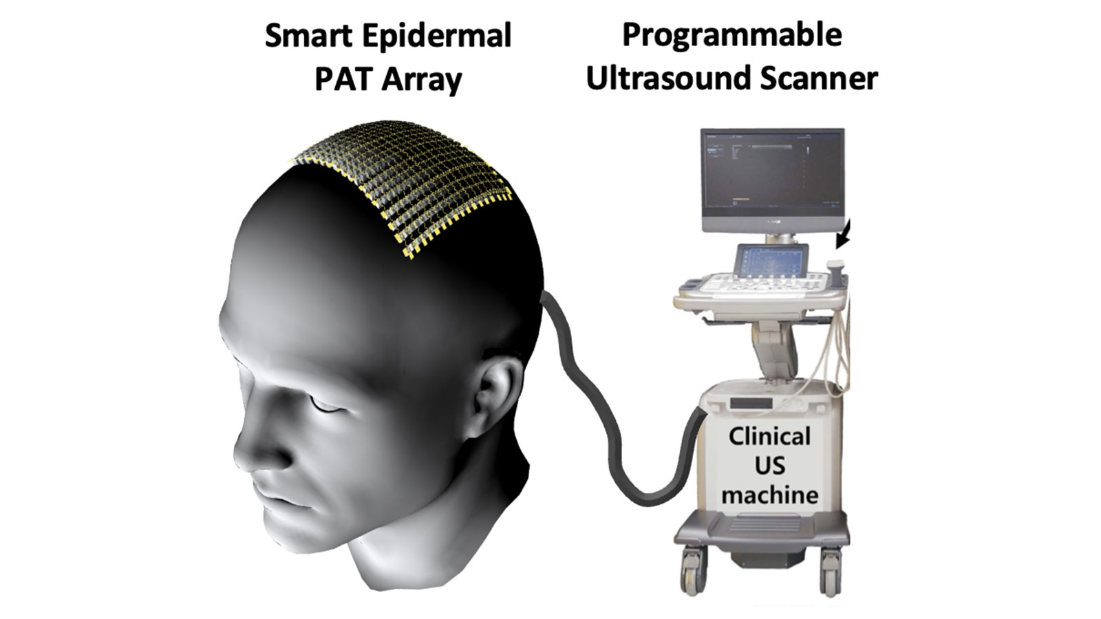 A low-profile, wearable imaging tool will be able to provide physicians with accurate, detailed, 3D brain images