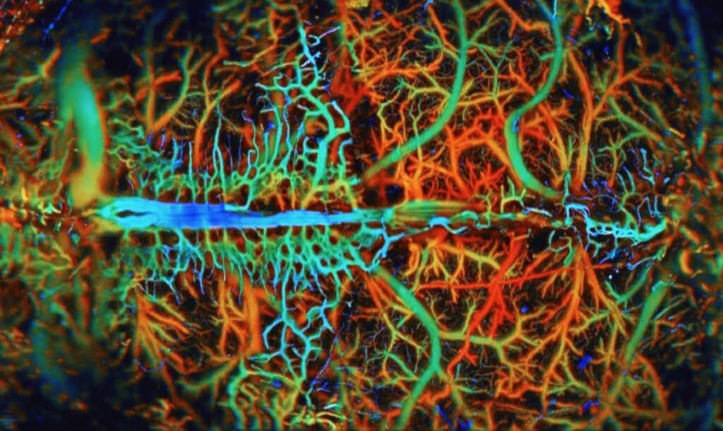 photoacoustic image of vasculature