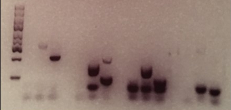 A white background with columns of dark splotches indicating where DNA has accumulated