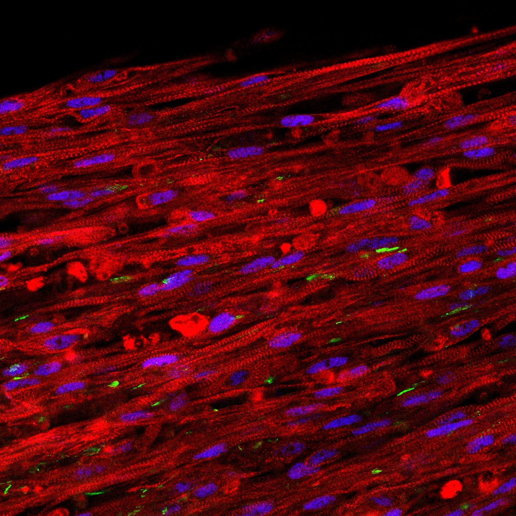 A stained cross section of the new muscle fibers. The red cells are striated muscle fibers, the green areas are receptors for neuronal input, and the blue patches are cell nuclei. (Credit: Bursac Lab)