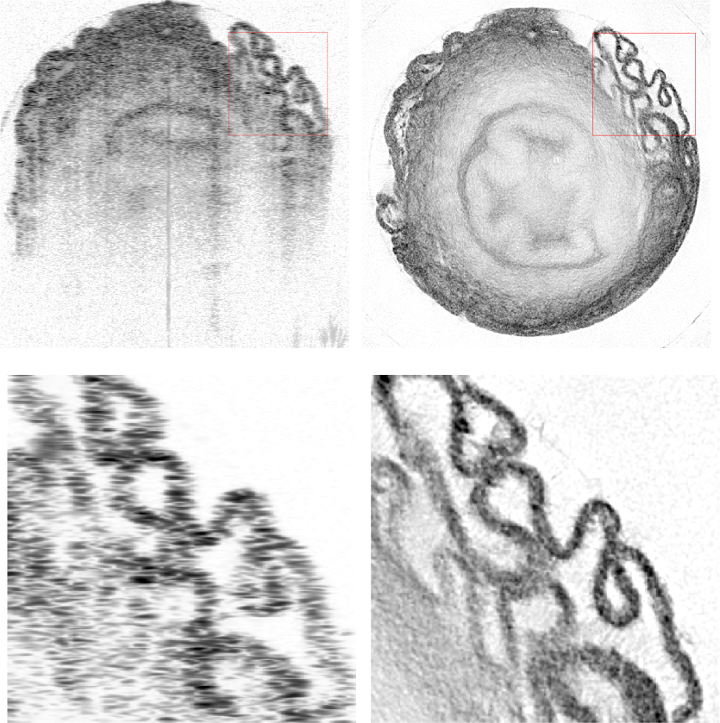 Two pairs of images of biological samples, top and bottom, where the left version is not as good as the right version