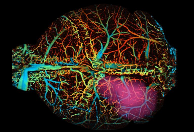 photoacoustic image of vasculature