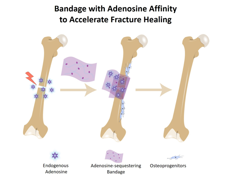A cartoon graphic depicting a bandage that attracts molecules and traps them near a bone break