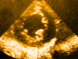 ultrasound