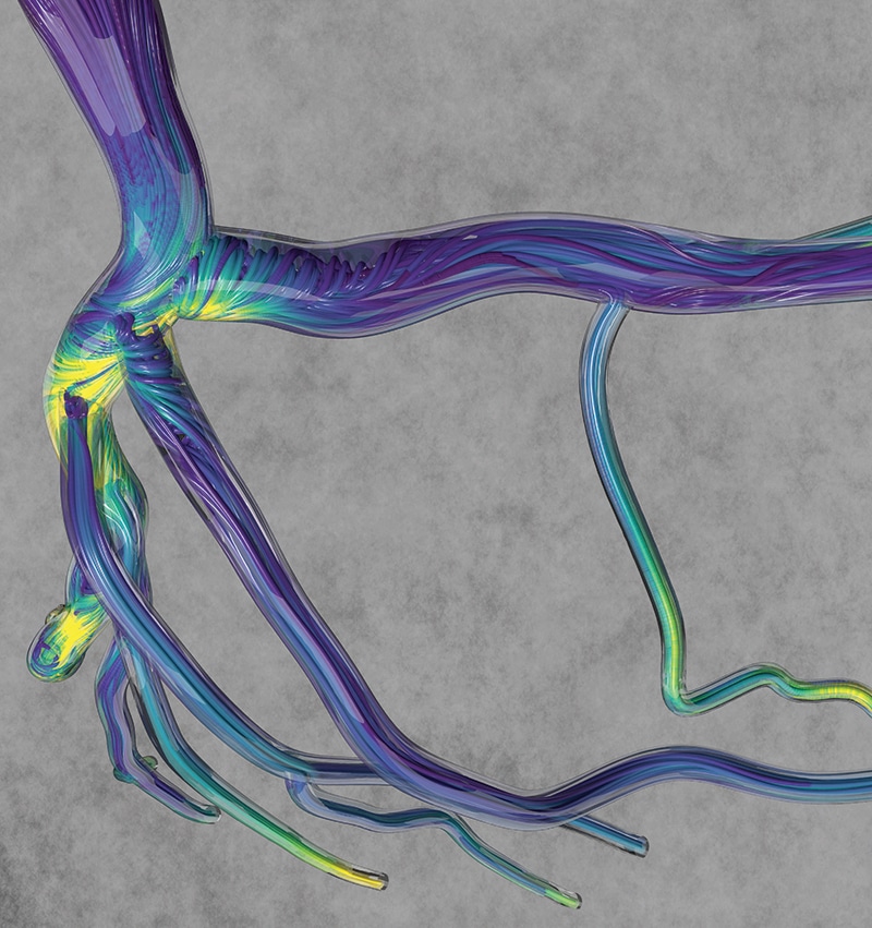 colorful rendition of the forces at work within the human vascular system