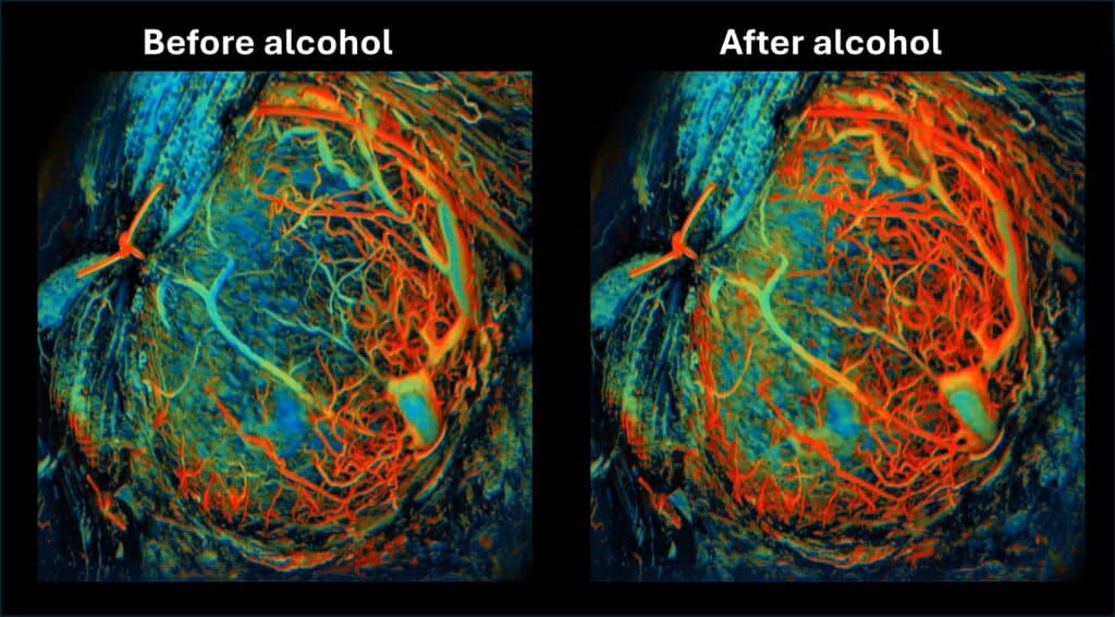 UFF-PAM showed that alcohol caused significant increase in oxygen levels in the placenta, which lasted three minutes. Red indicates higher levels of oxygen. 