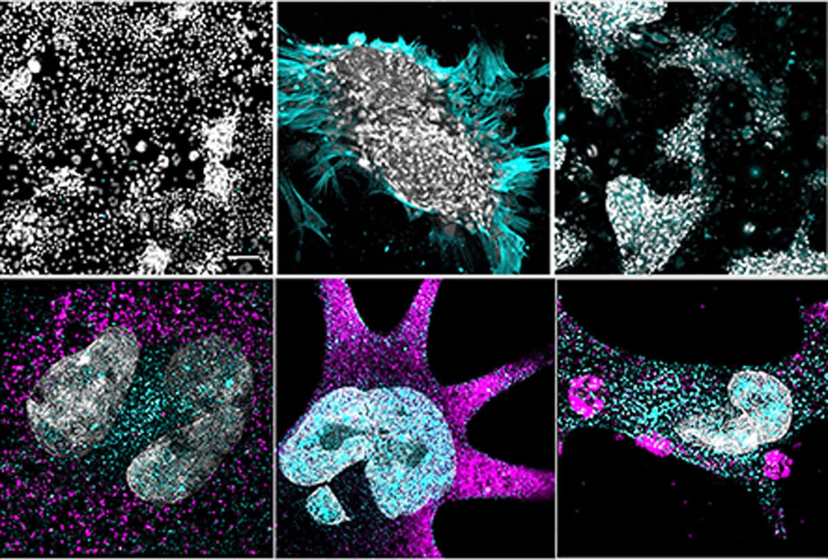 The immunofluorescent images show the expression of specific genes as the kidney cells develop.