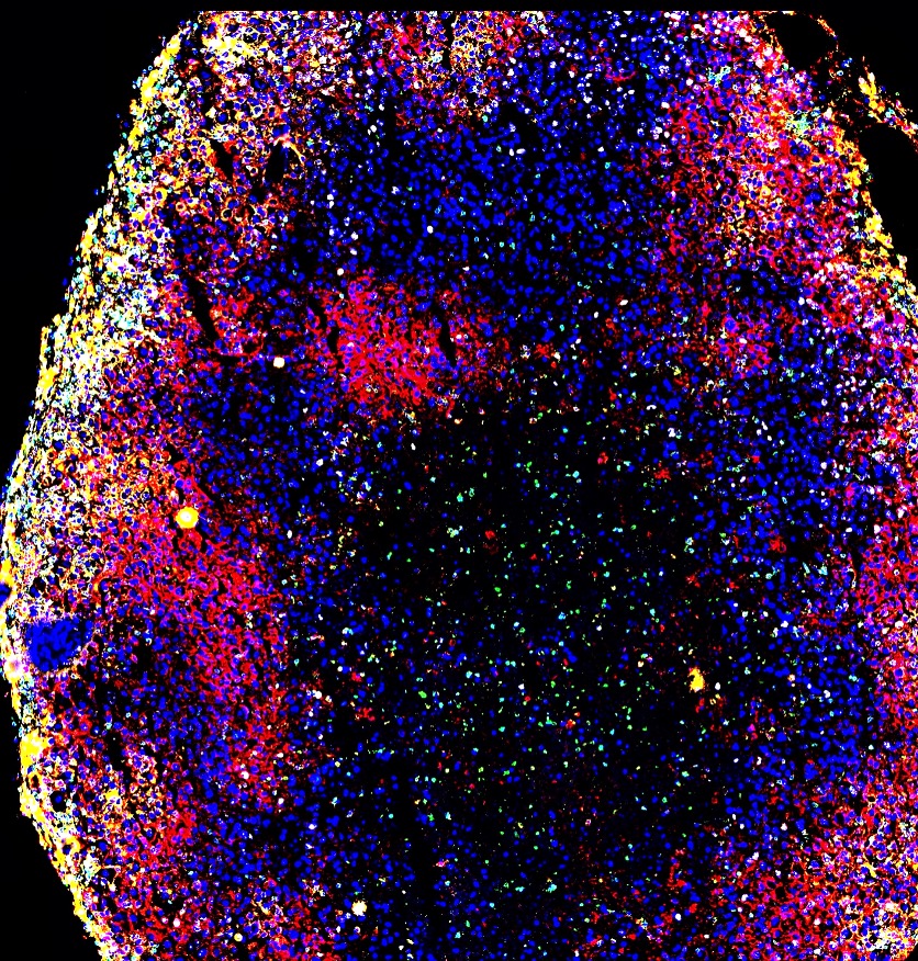 Various types of proteins are tagged with differently colored markers to help Hickey and his lab track activity