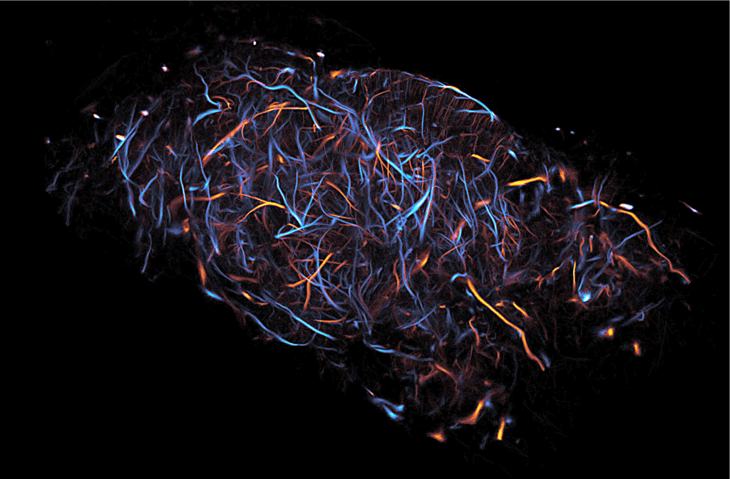 A New Vision for Lymphatic Imaging