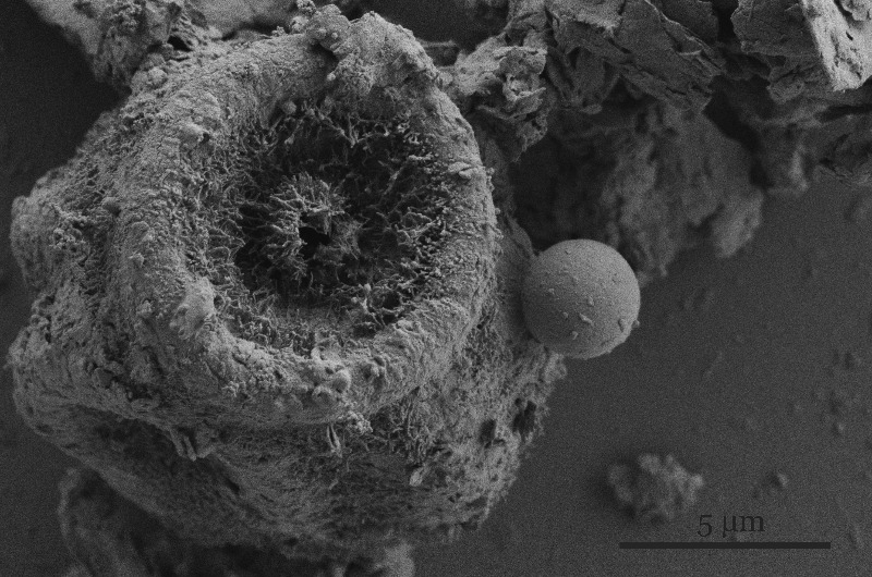 Image of possible fungal particulate matter taken with SEM